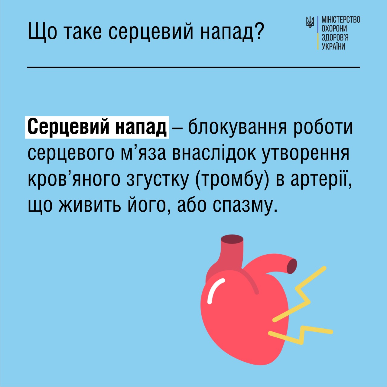 Медики рассказали украинцам, как избежать инфаркта