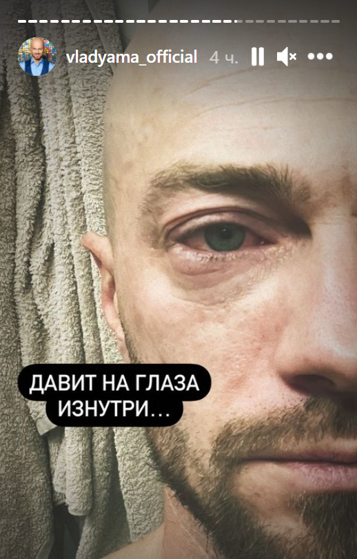 Влад Яма перенес отек Квинке и вызвал медиков