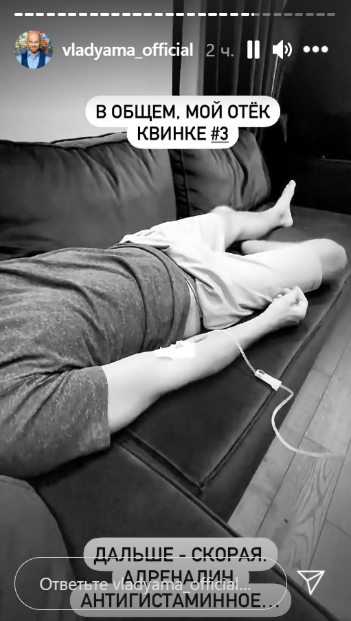 Влад Яма перенес отек Квинке и вызвал медиков