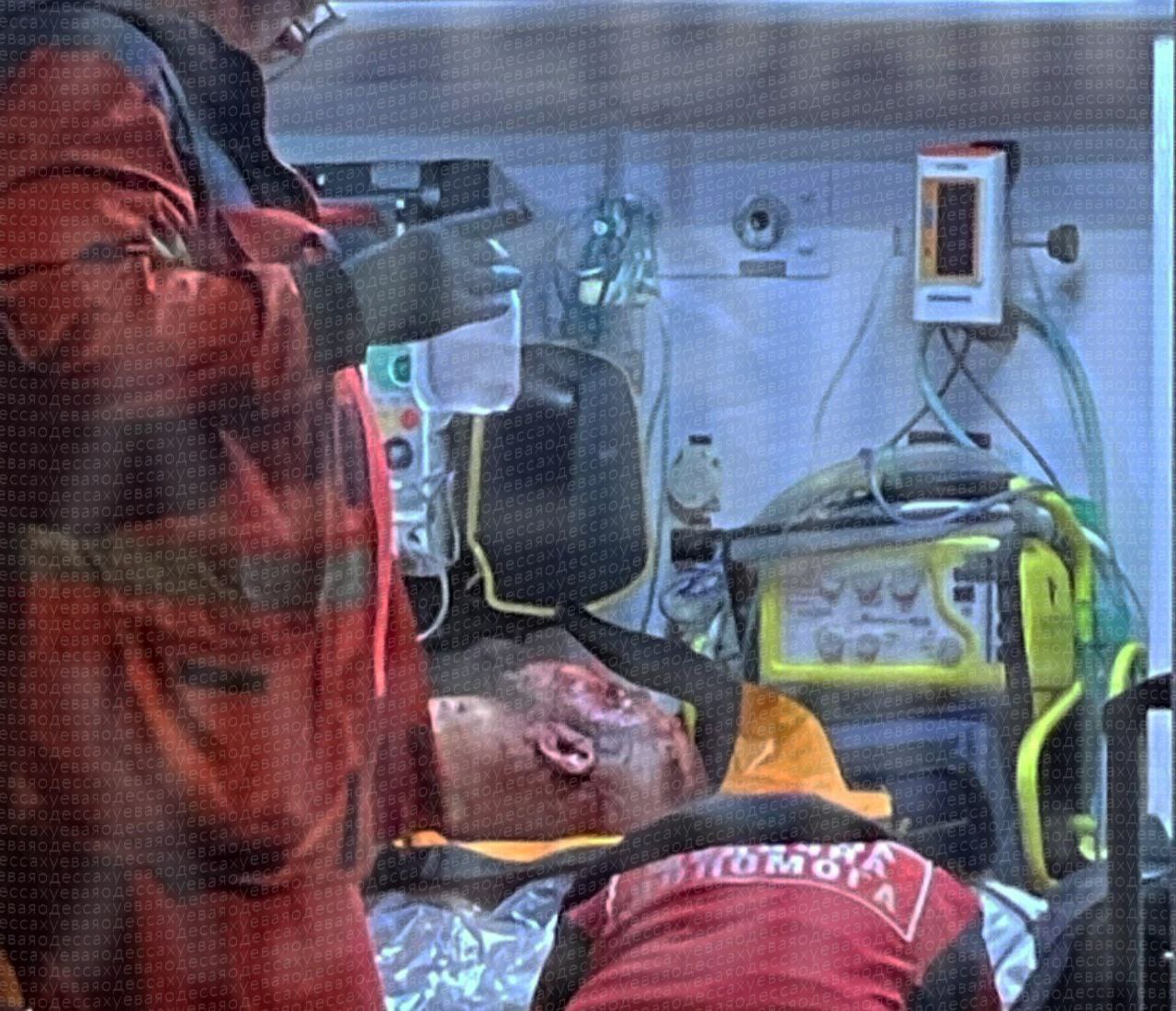 Фото пострадавшего от взрыва гранаты в Одессе. Источник - Телеграм